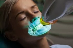 Teeth whitening Hot Springs AR