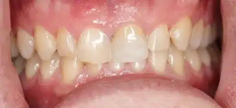 IMG_0103-1 (1) IMG 0103 1 1