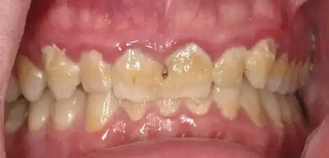 IMG_5584-1 IMG 5584 1