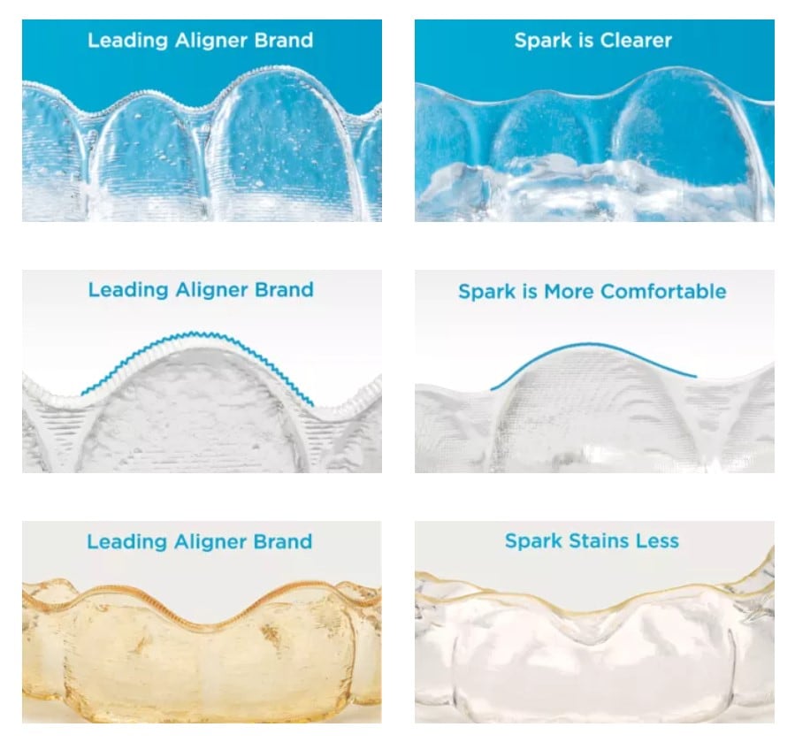 Spark-Aligners Spark Aligners