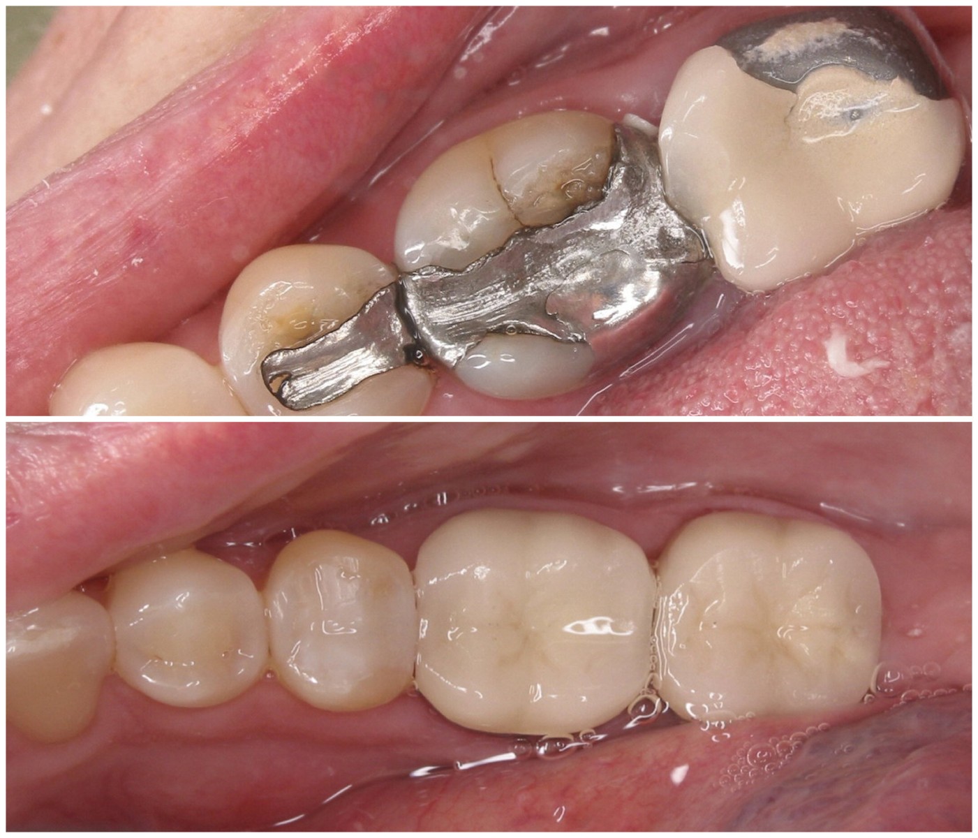 Before and After Image: Quadrant Dentistry - front
