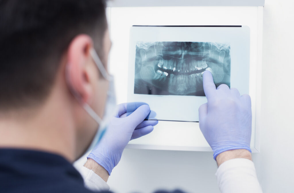 Dentist looking at a patient's dental X-rays to help determine the best course of oral treatment.